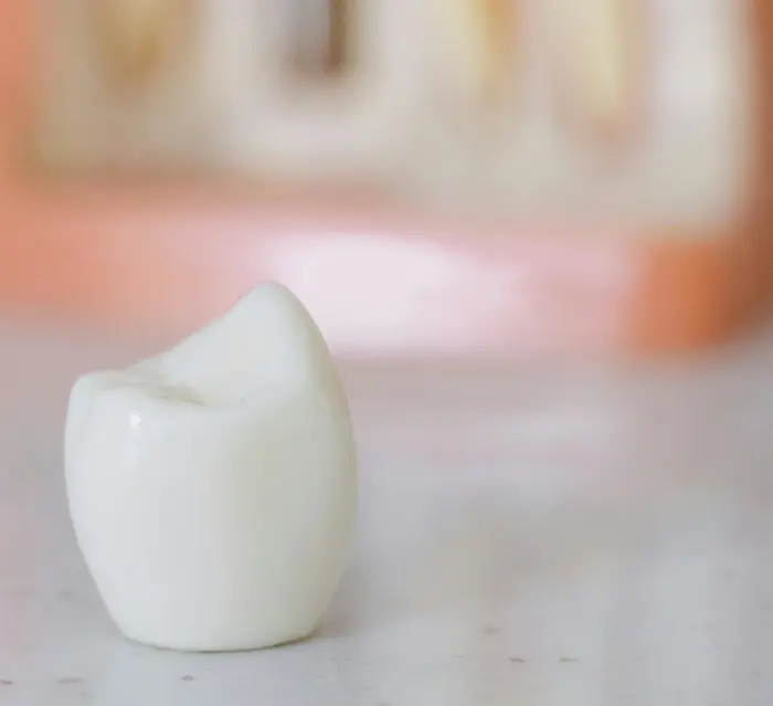 Same-Day Crowns vs Traditional Crowns: What's the Difference?