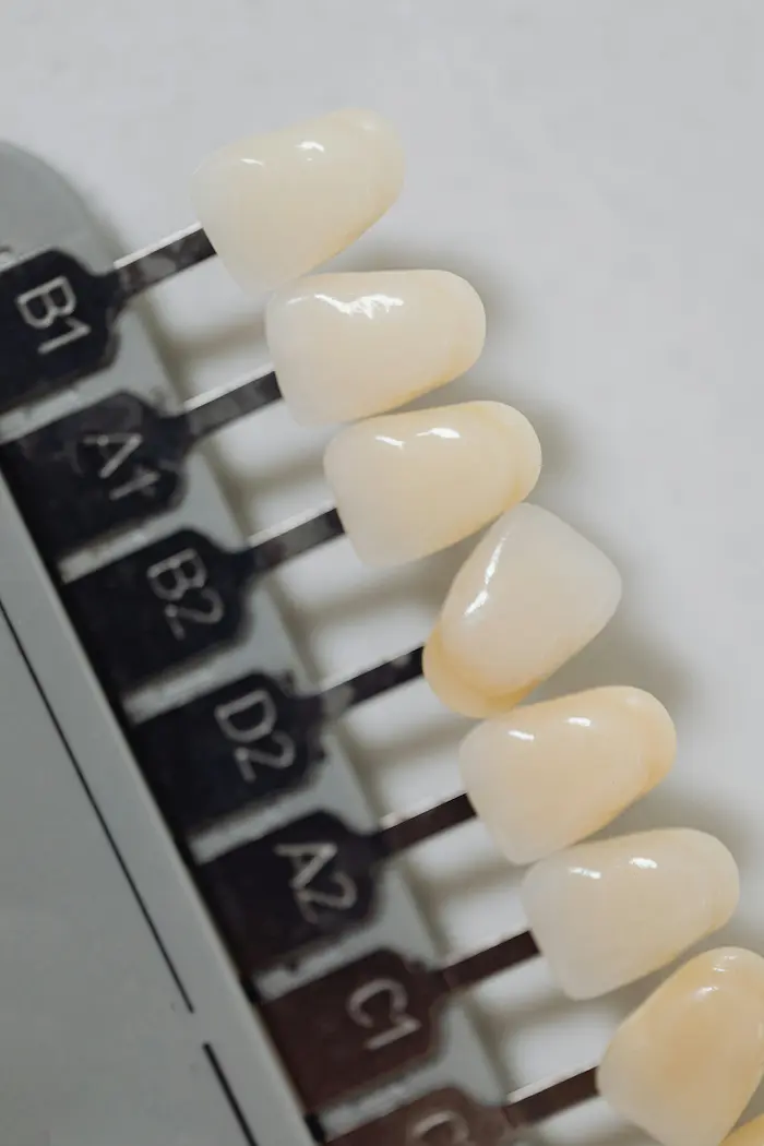 Porcelain Veneers: The Secret to a Hollywood Smile