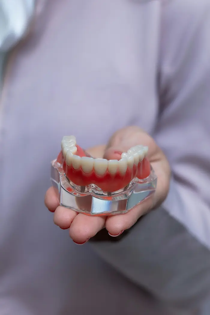 Everything You Need to Know About Dental Implants